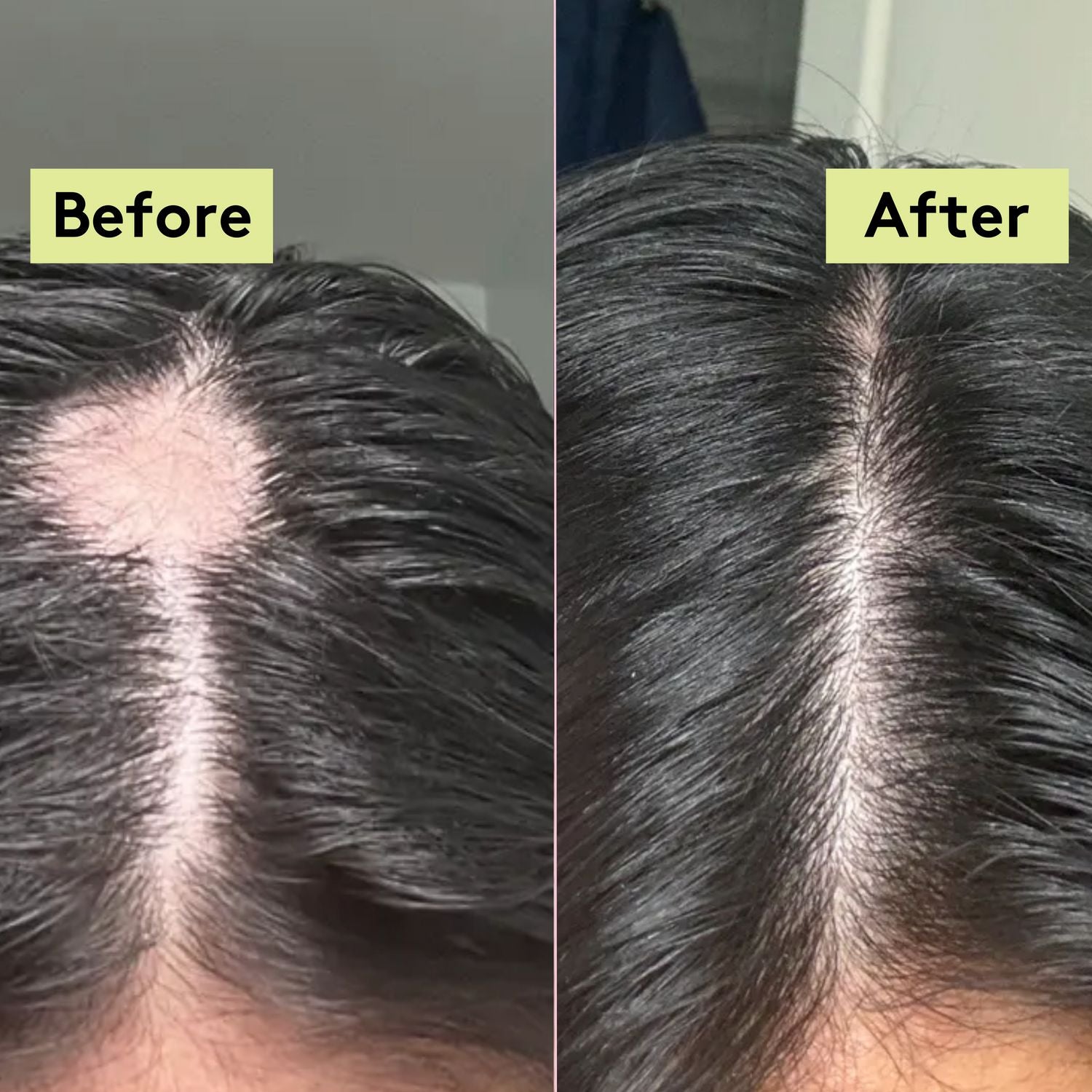 🌿 SN Organics  Herbal Hair Oil